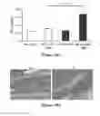 Fig. 26 - CS1-specific chimeric antigen receptor engineered immune effector cells