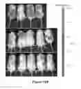 Fig. 27 - CS1-specific chimeric antigen receptor engineered immune effector cells