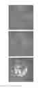 Fig. 01 - Methods and apparatus for cell culture array