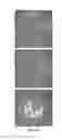 Fig. 06 - Methods and apparatus for cell culture array