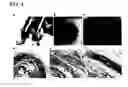 Fig. 03 - Multiloop engineered heart muscle tissue