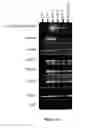 Fig. 04 - Polycistronic Vector for Human Induced Pluripotent Stem Cell Production