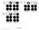 Fig. 13 - THERMOSENSITIVE MUTANTS OF INFLUENZA VIRUSES