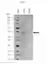 Fig. 03 - Thermostable β-glucosidase