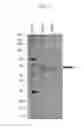 Fig. 03 - Thermostable β-glucosidase