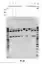 Fig. 28 - COMPOSITIONS AND METHODS OF NUCLEIC ACID-TARGETING NUCLEIC ACIDS