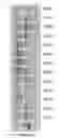 Fig. 55 - COMPOSITIONS AND METHODS OF NUCLEIC ACID-TARGETING NUCLEIC ACIDS