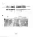 Fig. 08 - Effective delivery of large genes by dual AAV vectors