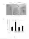 Fig. 09 - Effective delivery of large genes by dual AAV vectors