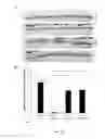 Fig. 11 - Effective delivery of large genes by dual AAV vectors