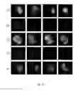 Fig. 15 - Effective delivery of large genes by dual AAV vectors