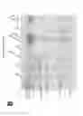 Fig. 18 - Probes and assays for measuring E3 ligase activity