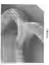 Fig. 10 - Method for thrombogenicity testing of implanted medical device