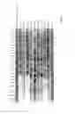 Fig. 04 - Method of examining the identity of strains of lactobacillus fermentum