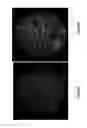 Fig. 36 - Assays for single molecule detection and use thereof