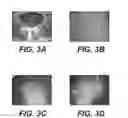Fig. 09 - Molecular targets for ALS and related disorders
