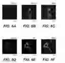 Fig. 12 - Molecular targets for ALS and related disorders