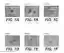 Fig. 14 - Molecular targets for ALS and related disorders