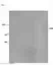 Fig. 05 - WARP KNITTING FABRIC EXPRESSING DESIGN PATTERN OF JACQUARD TEXTURE ON GROUND ORGANIZATION