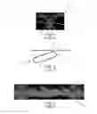 Fig. 02 - Method of making nonwoven material having discrete three-dimensional deformations with wide base openings