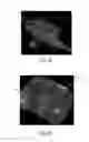 Fig. 05 - Method of making nonwoven material having discrete three-dimensional deformations with wide base openings