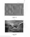 Fig. 08 - Method of making nonwoven material having discrete three-dimensional deformations with wide base openings