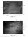 Fig. 11 - Method of making nonwoven material having discrete three-dimensional deformations with wide base openings