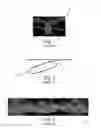 Fig. 02 - Apparatus having forming members with surface texture for making nonwoven material having discrete three-dimensional deformations with wide base openings