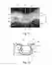 Fig. 07 - Apparatus having forming members with surface texture for making nonwoven material having discrete three-dimensional deformations with wide base openings