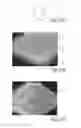 Fig. 17 - Apparatus having forming members with surface texture for making nonwoven material having discrete three-dimensional deformations with wide base openings