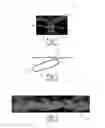 Fig. 02 - Method Of Making Nonwoven Material Having Discrete Three-Dimensional Deformations With Wide Base Openings Using Forming Members With Surface Texture