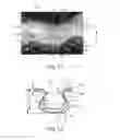 Fig. 07 - Method Of Making Nonwoven Material Having Discrete Three-Dimensional Deformations With Wide Base Openings Using Forming Members With Surface Texture