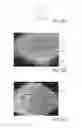 Fig. 17 - Method Of Making Nonwoven Material Having Discrete Three-Dimensional Deformations With Wide Base Openings Using Forming Members With Surface Texture