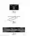 Fig. 02 - Nonwoven material having discrete three-dimensional deformations that are configured to collapse in a controlled manner