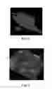 Fig. 05 - Nonwoven material having discrete three-dimensional deformations that are configured to collapse in a controlled manner