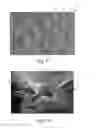 Fig. 08 - Nonwoven material having discrete three-dimensional deformations that are configured to collapse in a controlled manner