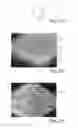Fig. 17 - Nonwoven material having discrete three-dimensional deformations that are configured to collapse in a controlled manner
