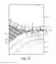 Fig. 19 - Nonwoven material having discrete three-dimensional deformations that are configured to collapse in a controlled manner