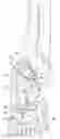 Fig. 01 - COMPOSITE DIAPHRAGM FOR ROLLER CONE PRESSURE COMPENSATION SYSTEM