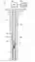 Fig. 01 - Downhole casing pulling tool