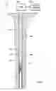 Fig. 02 - Downhole casing pulling tool