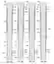 Fig. 11 - Downhole casing pulling tool