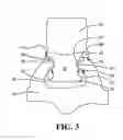 Fig. 04 - Tangential blade root neck conic