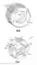 Fig. 05 - Fan drive gear system with improved misalignment capability
