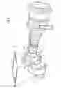 Fig. 07 - COMPOSITE MATERIAL INLET PLENUM AND GAS TURBINE ENGINE SYSTEM COMPRISING SAID PLENUM