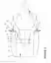 Fig. 03 - Engine with a thrust reverser lockout mechanism