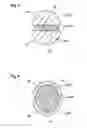 Fig. 04 - Fuel-injection system having a fuel-conducting component, a fuel injector and a suspension mount