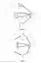 Fig. 06 - High-low pad retraction spring