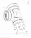 Fig. 11 - Mechanical restraint member