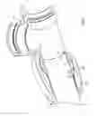 Fig. 23 - Mechanical restraint member